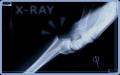 background: Unusual Limits X-ray